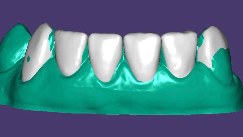 Paciente 4, primera foto del tratamiento
