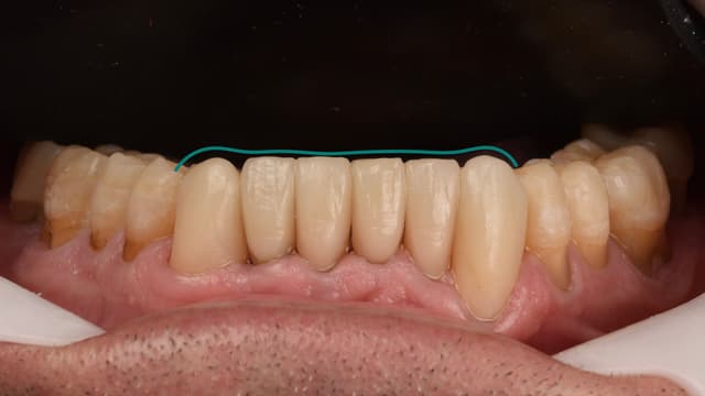 Paciente 2 - Image 3