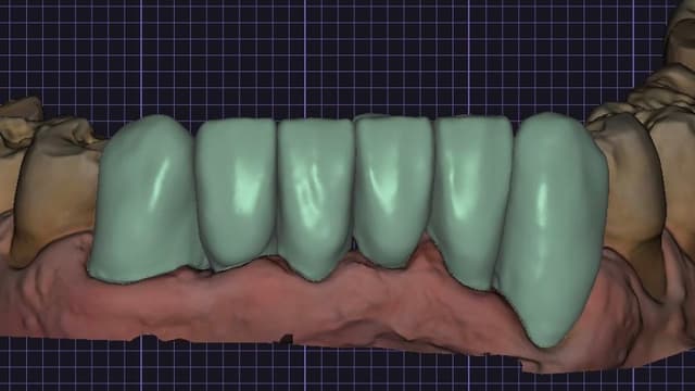 Paciente 2 - Image 2