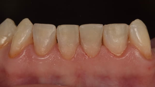 Paciente 4 - Image 4