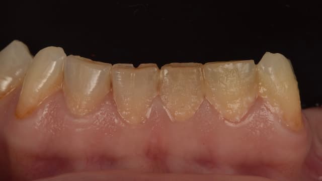 Paciente 4 - Image 1