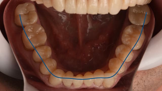 Paciente 2 - Image 5