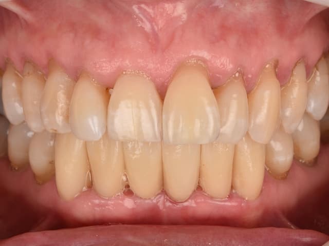 Paciente 1 - Image 6