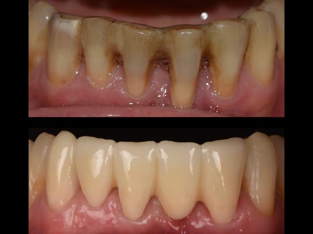 Paciente 6 - Image 6