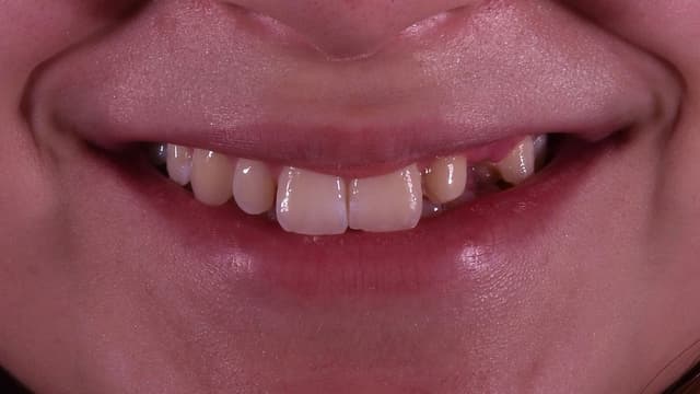 Paciente 3 - Image 1