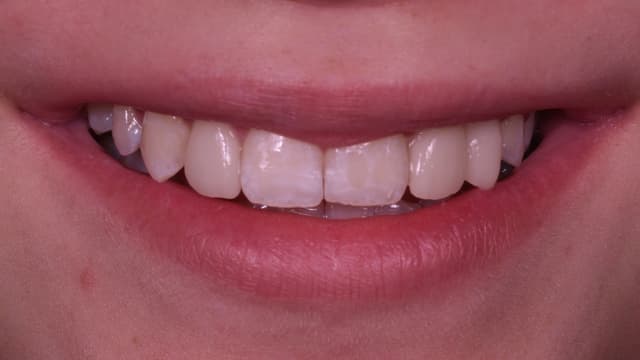 Paciente 3 - Image 5