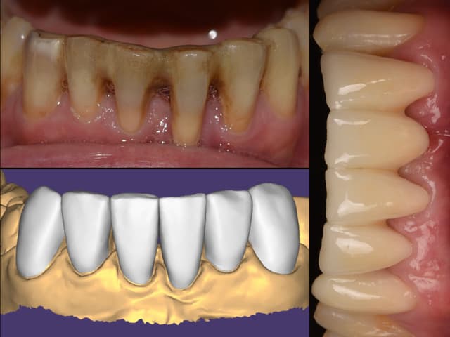 Paciente 6 - Image 2